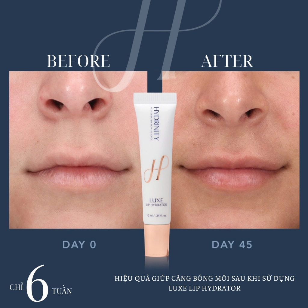 HYDRINITY LUXE LIP HYDRATOR: Khoa Học Gặp Gỡ Sang Trọng - "Filler Không Tiêm" Cho Đôi Môi Căng Mọng