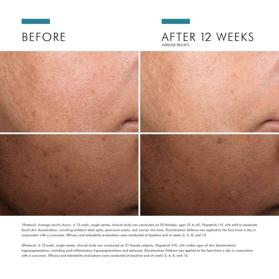 SKINCEUTICALS DISCOLORATION DEFENSE/ SERUM MỜ THÂM NÁM VÀ LÀM SÁNG ĐỀU MÀU DA