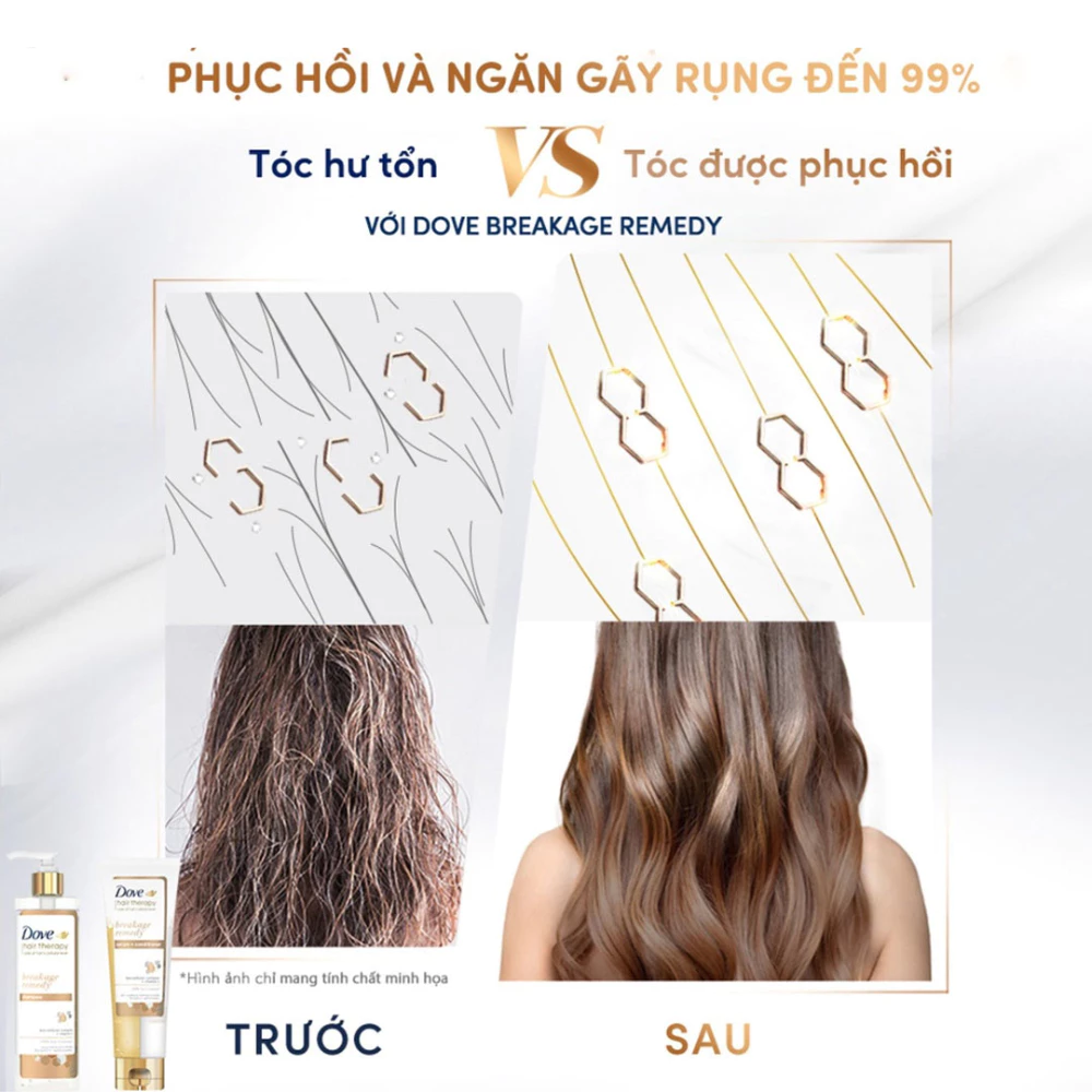 Dầu gội Dove phục hồi & ngăn gãy rụng 380ml