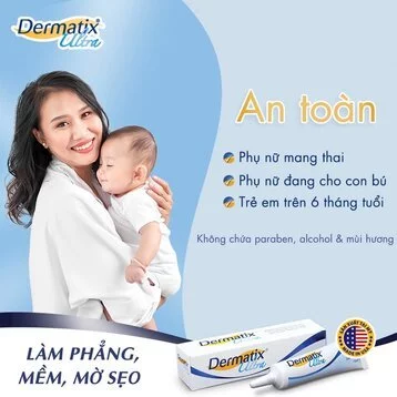 Kem dưỡng Dermatix hỗ trợ mờ sẹo 7g