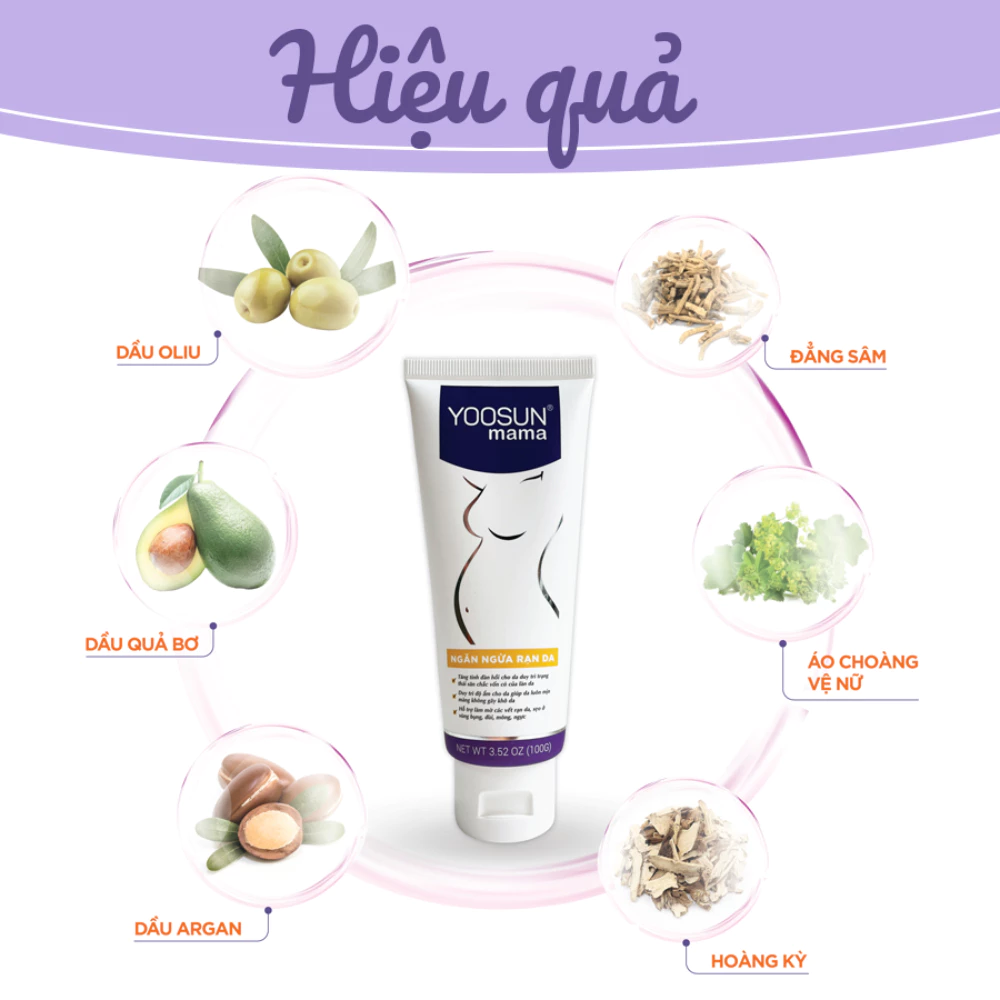 Kem ngăn ngừa rạn da Yoosun Mama 100g