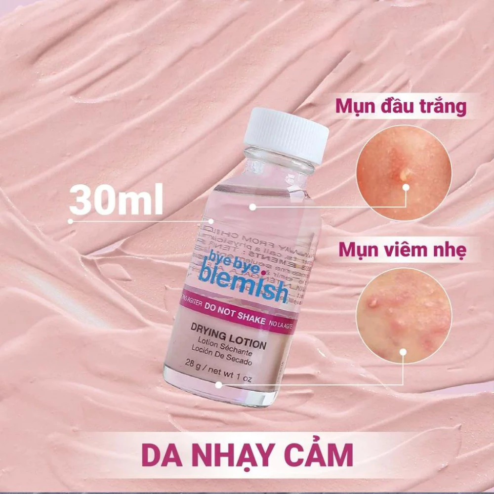 Lotion chấm mụn Bye Bye Blemish mụn sưng viêm/ mụn trắng/ mụn thâm/ mụn trắng nhạy cảm 30ML