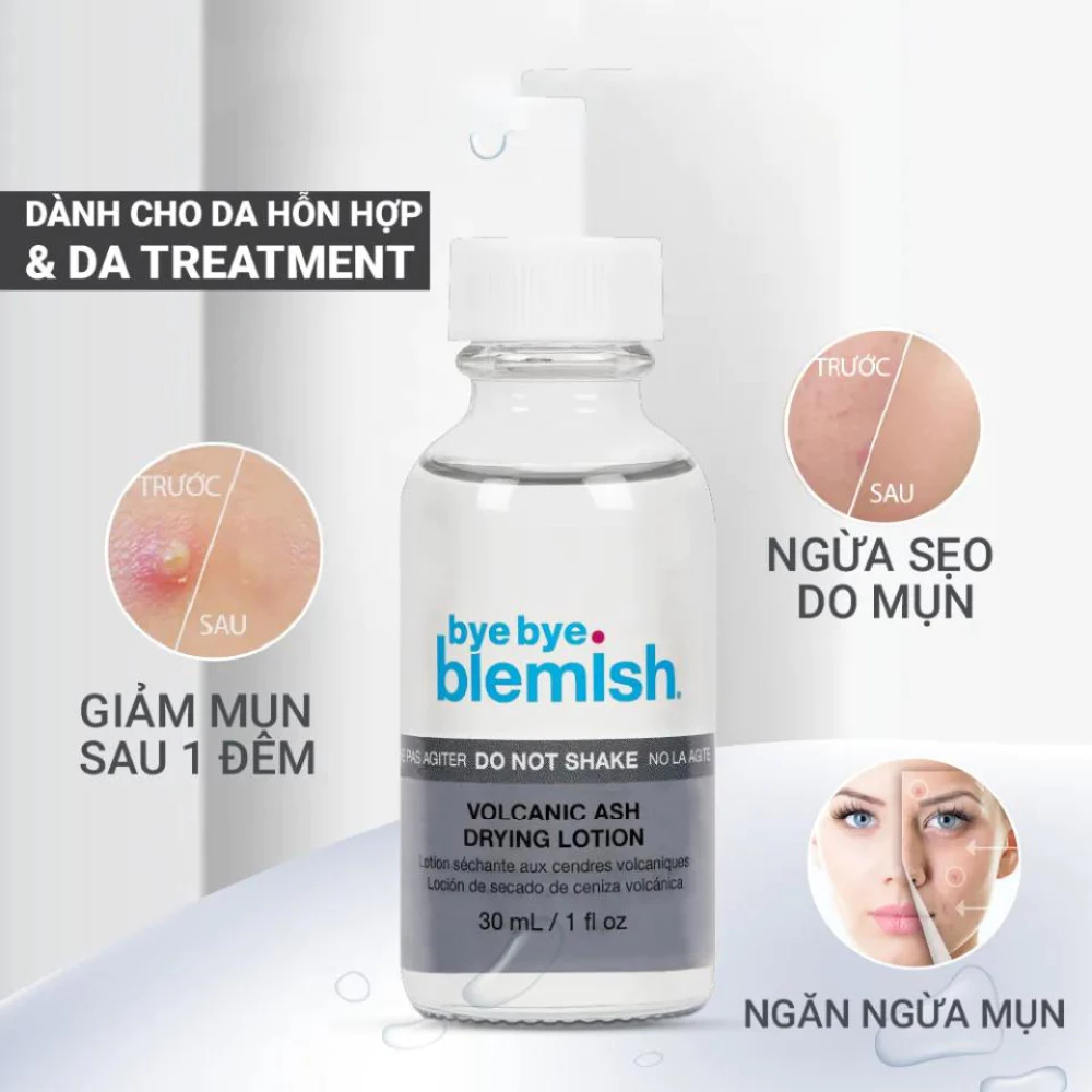 Lotion chấm mụn Bye Bye Blemish mụn sưng viêm/ mụn trắng/ mụn thâm/ mụn trắng nhạy cảm 30ML