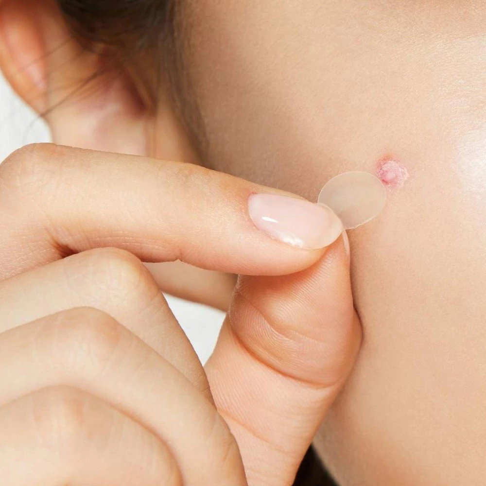 Miếng dán mụn Derma Angel dùng cho ngày & đêm 18 miếng và ngày/dêm 12 miếng