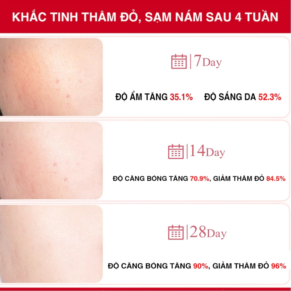 Serum Angel's Liquid xóa thâm đỏ mờ sạm nám 30ml