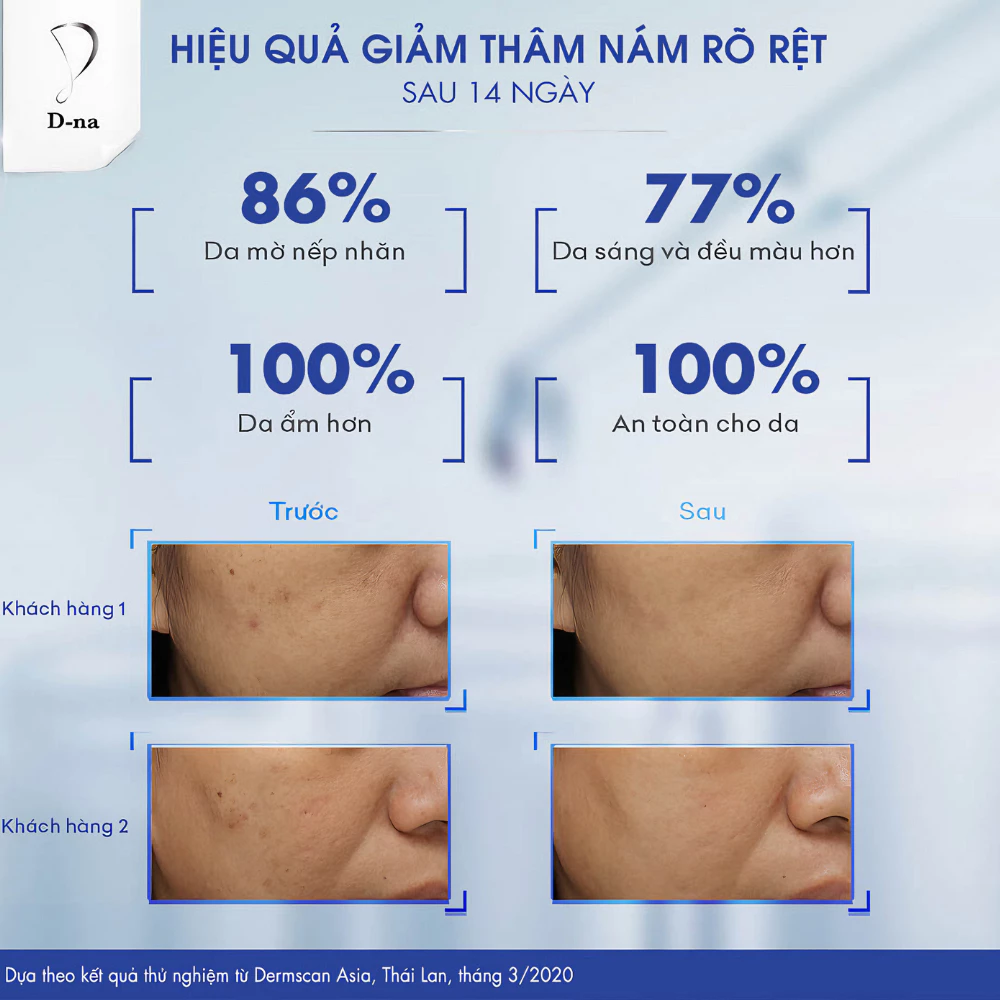 Serum D-na dưỡng sáng chuyên sâu, mờ sạm nám 30g
