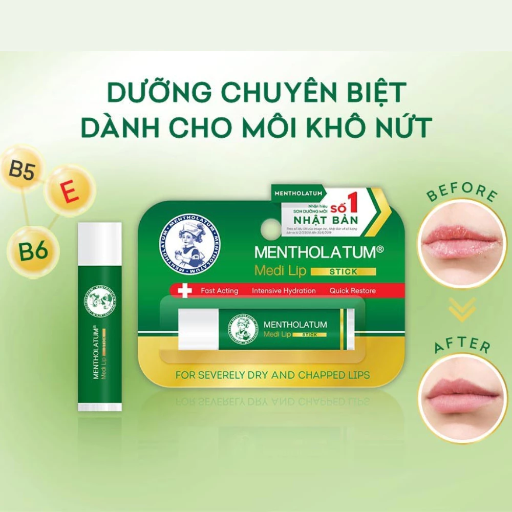 Son dưỡng Mentholatum chuyên biệt cho môi khô, nứt nẻ 4.3g