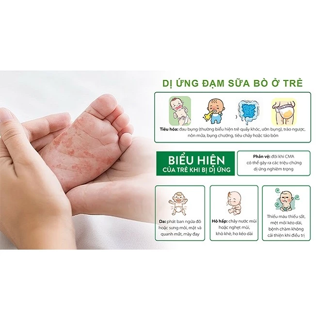 Sữa bột Meiji HP cho bé dị ứng đạm sữa bò 850g