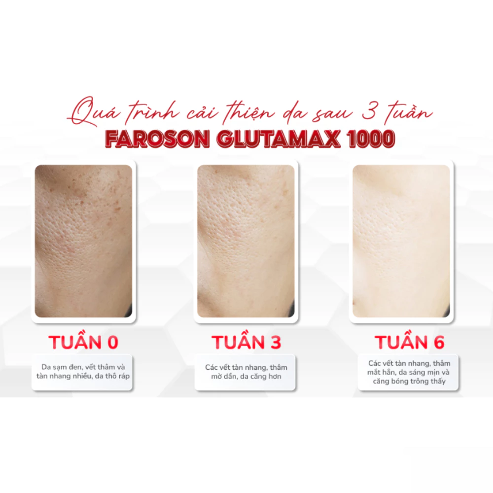 Viên uống Faroson chống nắng, dưỡng sáng da hộp 30 viên