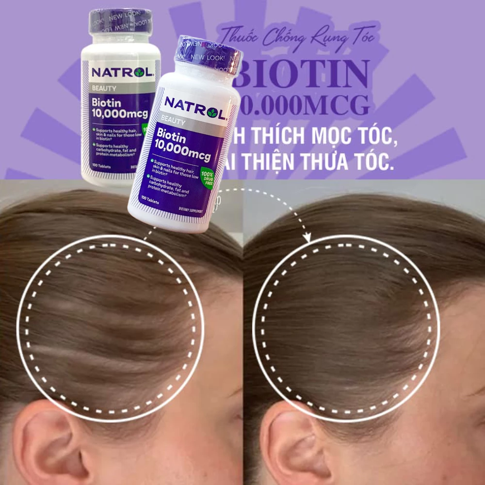 Viên uống mọc tóc Natrol Biotin 10000 mcg (100 viên)