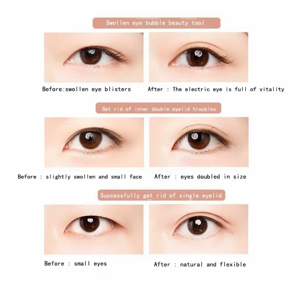 Kích Mí UNNY Size M (90 miếng)