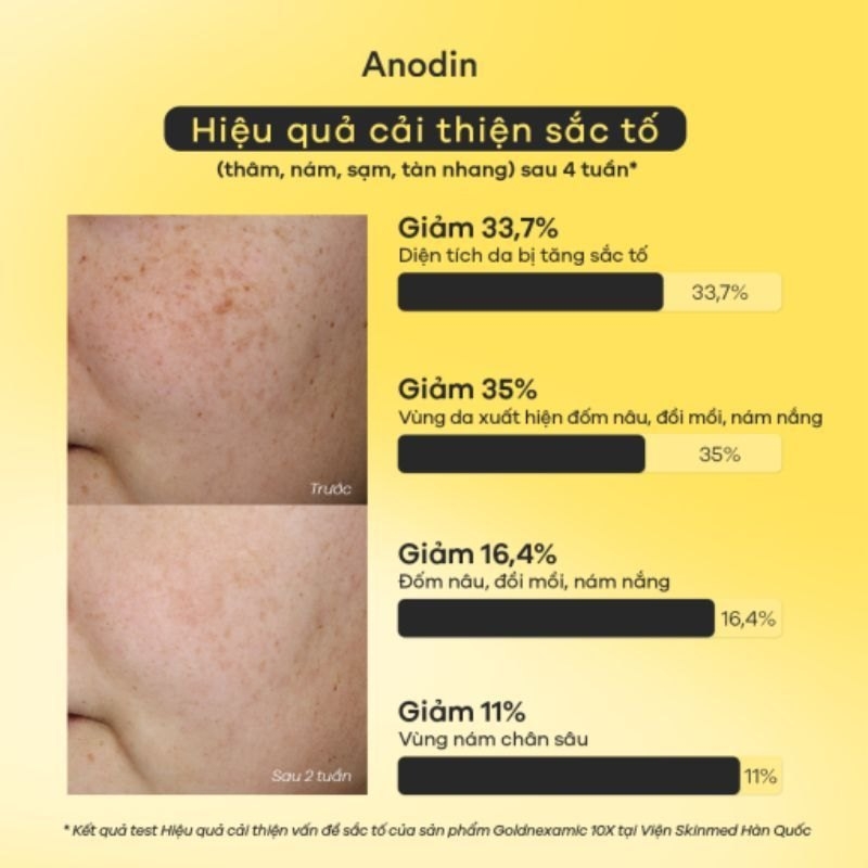 Serum dưỡng da ANODIN GOLDNEXAMIC 10X SERUM