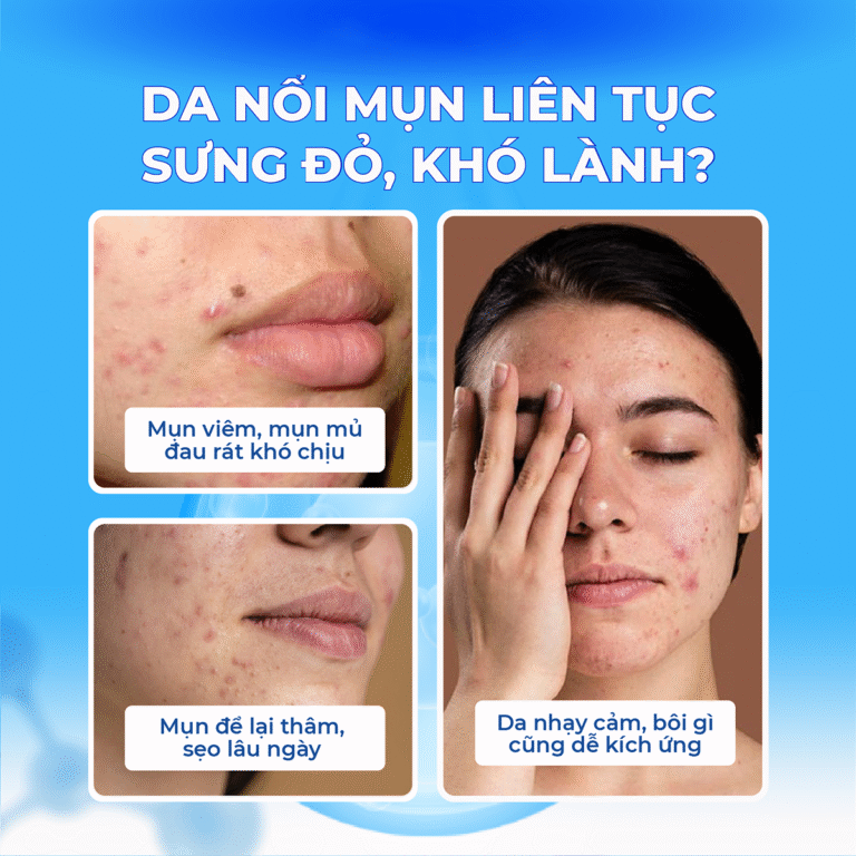 CHẤM MỤN G1 AC CONTROL SOLUTION 30ML (G.LOV.U G1 AC CONTROL SOLUTION8809626569135)