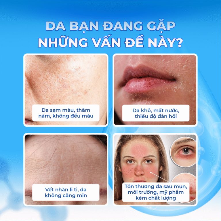 KEM NỮ HOÀNG HỒNG ỐC SÊN 60ML(QUEEN CHARM PREMIUM INTENSIVE SNAIL DAY&NIGHT CREAM-8809936050187)