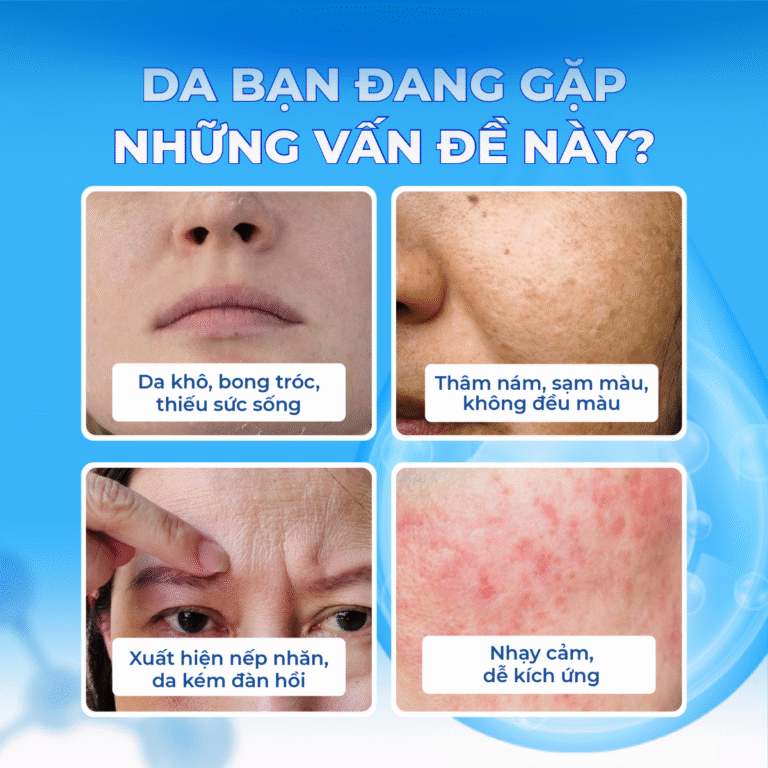 KEM NỮ HOÀNG TÍM CAO CẤP 50ML (QUEEN CHARM VOLUX PREMIUM CREAM8809514487688)