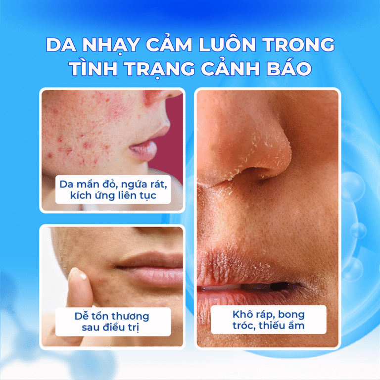 THẢI ĐỘC VÀ LÀM DỊU DA G2 SKIN SOOTHING SOLUTION 30ML (G.LOV.U G2 SKIN SOOTHING SOLUTION-8809626569142