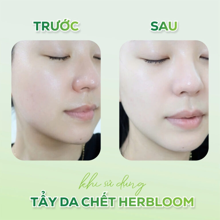 Tẩy da chết Herbloom green papain soft peeling gel Thương hiệu: Herbloom 120ml/tuýp