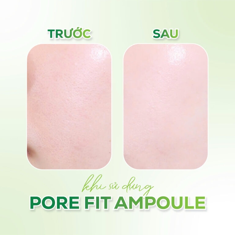 Tinh chất veggie vita pore fit ampoule Thương hiệu: Herbloom 30ml/chai