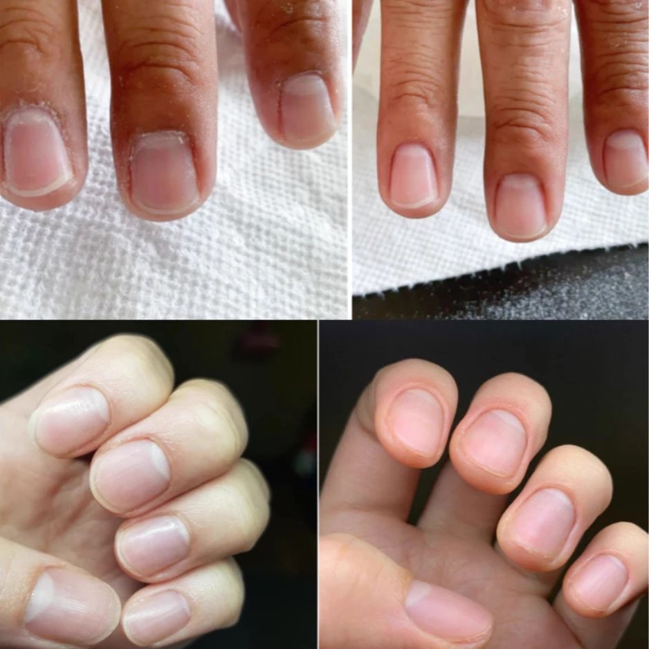 Kem Mềm Da Blue Cross Cuticle Remover 177ml