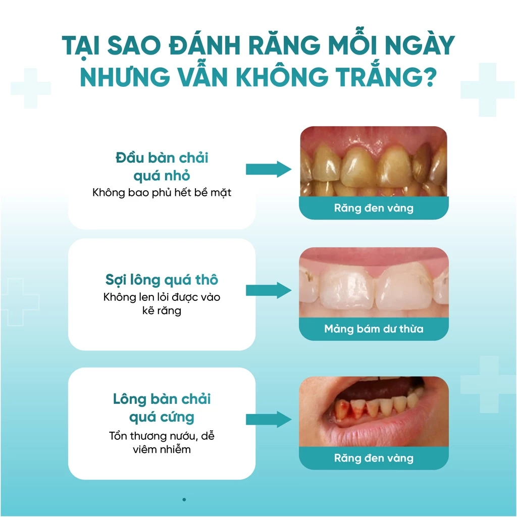 Bàn chải Royalead chuôi lỗ màu Be