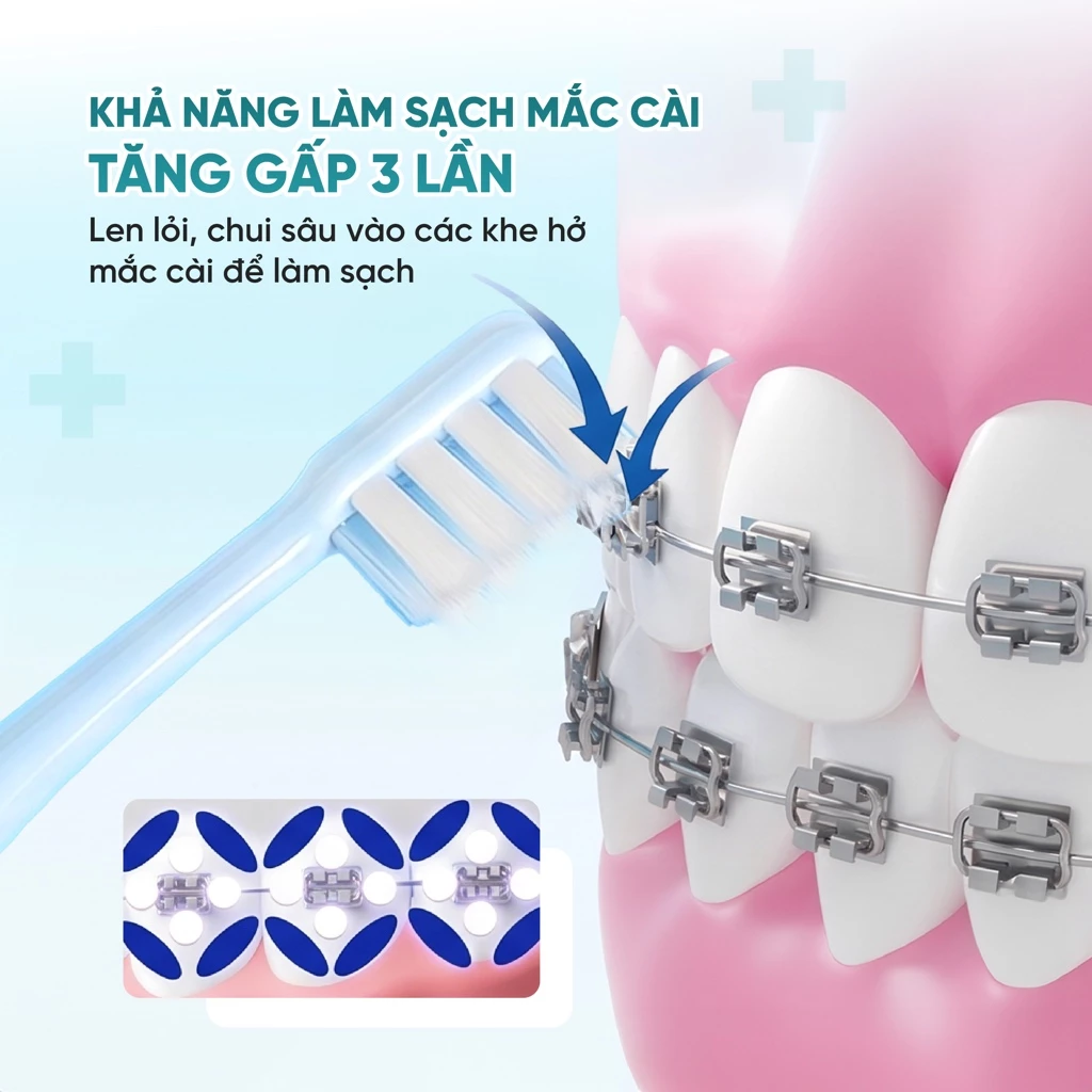 Bộ 2 bàn chải đánh răng chỉnh nha - Xanh