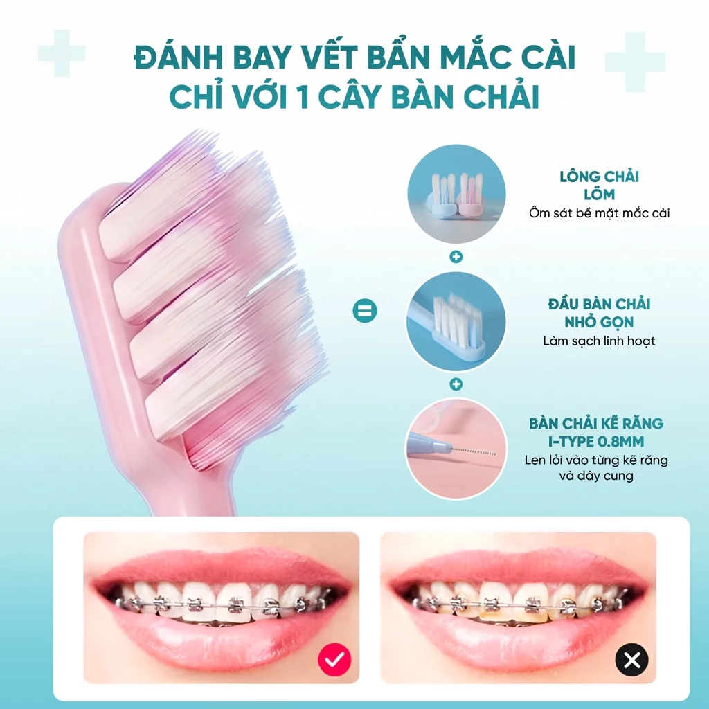 Bộ 2 bàn chải đánh răng chỉnh nha - Xanh