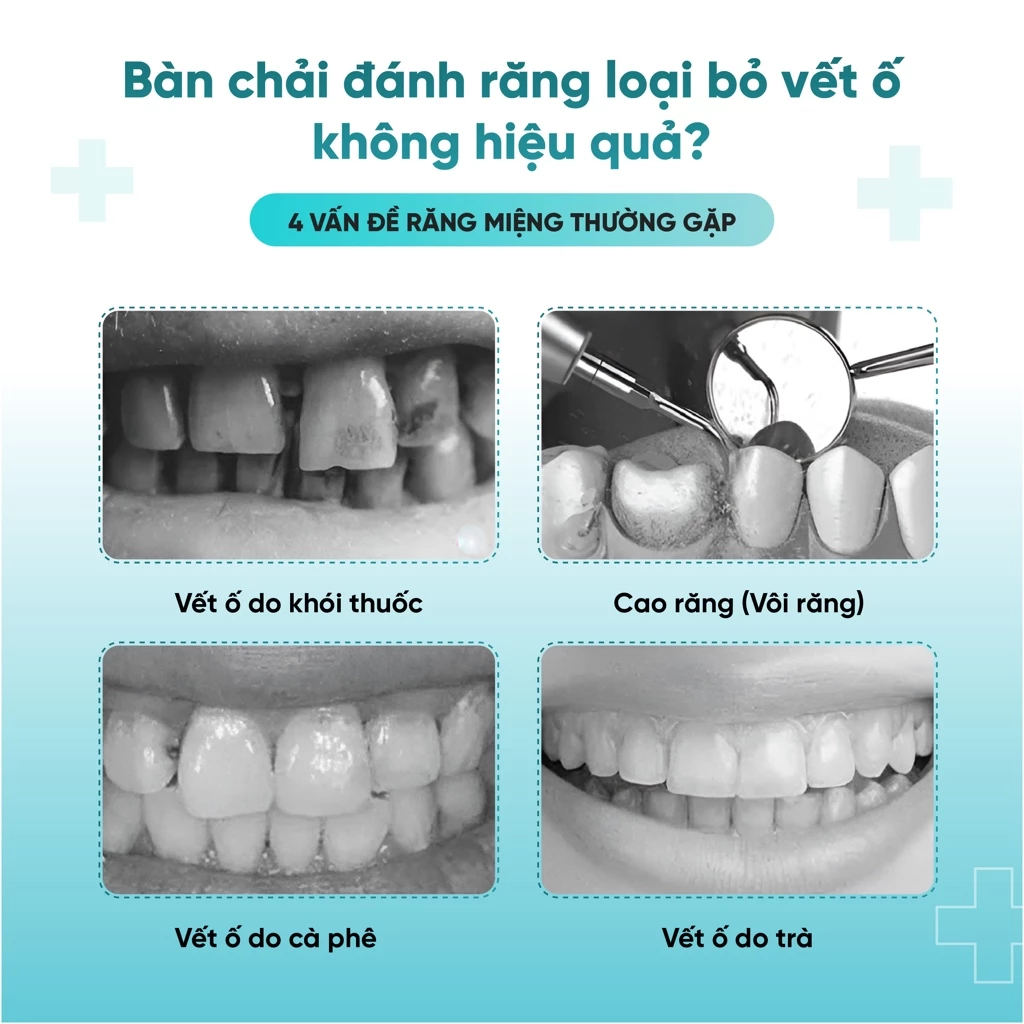 Hộp 9 bàn chải đánh răng lông cứng