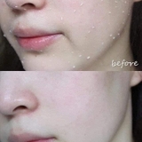 Tẩy Tế Bào Chết Dạng Gel Dịu Nhẹ CURE Natural Aqua Gel 250g