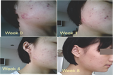 BỘ SẢN PHẨM Dr.EUZAPHIL 