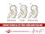 Dị tật ống thần kinh thai nhi -  mẹ nhất định phải tìm hiểu để không “làm khổ con”