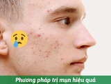 Một số phương pháp trị mụn nhanh và hiệu quả