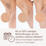 Máy triệt lông IPL Philips Lumea 8000 BRI946/00