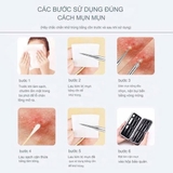 Sét Dụng Cụ Nặn Mụn JPNK Pro