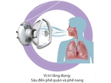 Máy xông khí dung siêu âm Air Plus III MediTime