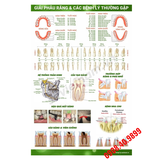 Tranh giải phẫu răng & các bệnh lý thường gặp
