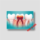 Tranh nha khoa 3D thiết kế hiện đại mới - MS12
