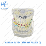 Hàm tư vấn chỉnh nha full khí cụ có nhổ răng