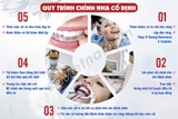 Tranh Quy trình chỉnh nha cố định