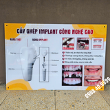 Tranh Implant nha khoa - MS13