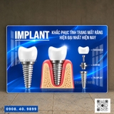 Tranh Implant nha khoa- MS22