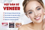 Tranh Mặt dán sứ Veneer