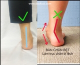 Sandals 2 Khóa BÀN CHÂN BẸT - Làm theo tình trạng chân
