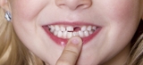 Tại sao nha sĩ khuyên cất giữ răng sữa của trẻ để khi cần có thể cứu mạng con?