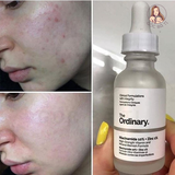 SERUM THE ORDINARY