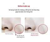 TẨY TẾ BÀO CHẾT SINH HỌC STING PEEL BE'BALANCE