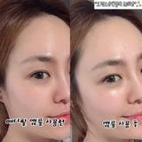 Tinh chất trắng da Medi peel Glutathione White Ampoule Serum 30ml