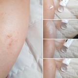 Kem Dưỡng Ẩm & Phục Hồi Da La Roche-Posay Cicaplast Baume B5+