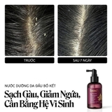 Nước Dưỡng Da Đầu Bồ Kết Làm Giảm Gàu Cocoon