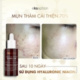 Tinh Chất Ekseption Hyaluronic Niacin Mixlab Serum 75ml