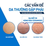 Kem dưỡng ẩm CeraVe Moisturizing Cream